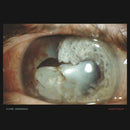 Flying Horseman - Anaesthesia (LP) - Discords.nl