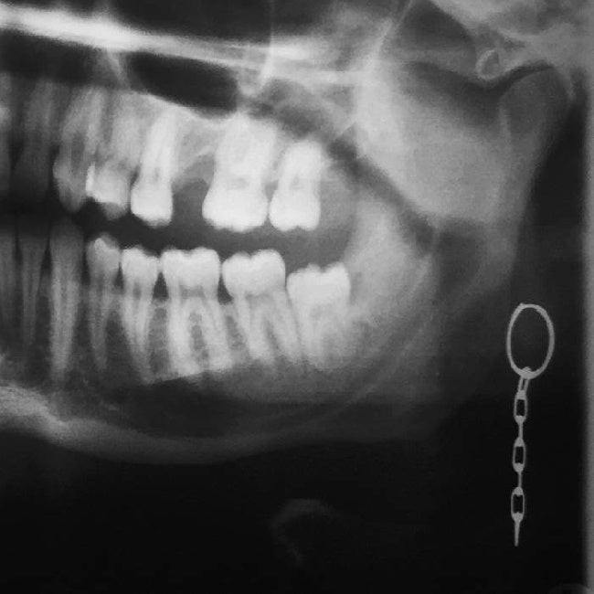 L.f.t. - Hollow head (LP) - Discords.nl